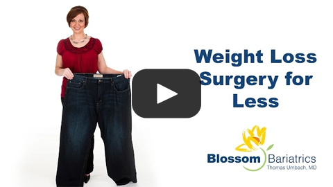 Weight Loss Surgery for Less | Sleeve Surgery