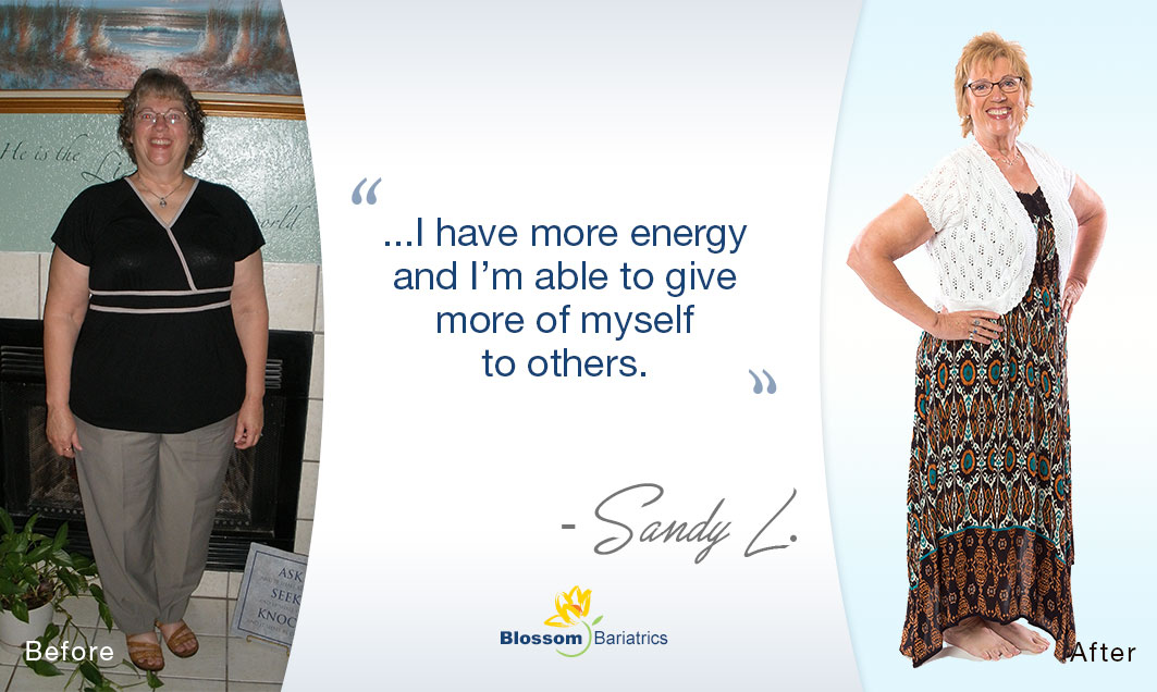 Sandy’s Weight Loss Story*