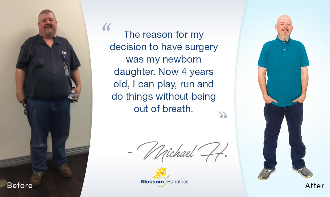 Michael’s Weight Loss Success Story*