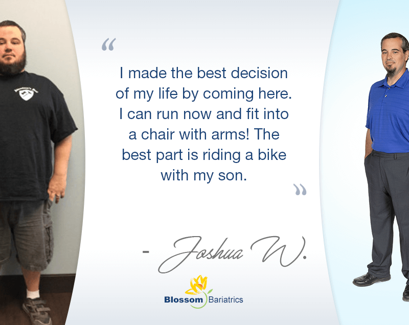 Joshua W Bariatric Weight Loss Photo