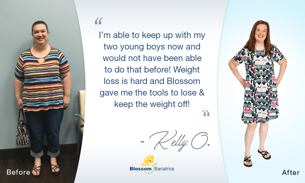 Kelly O - Bariatric Weight Loss Success