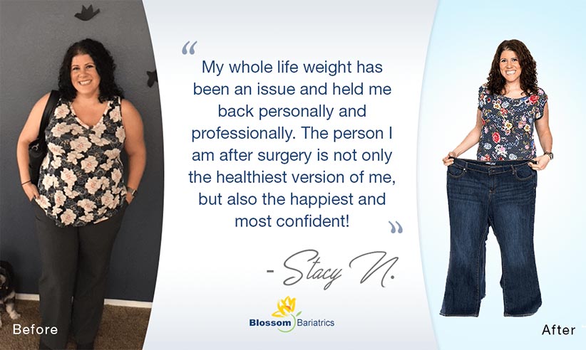Stacy N. – Weight Loss Success Story*