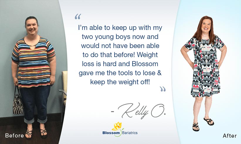 Kelly O – Bariatric Weight Loss Success*
